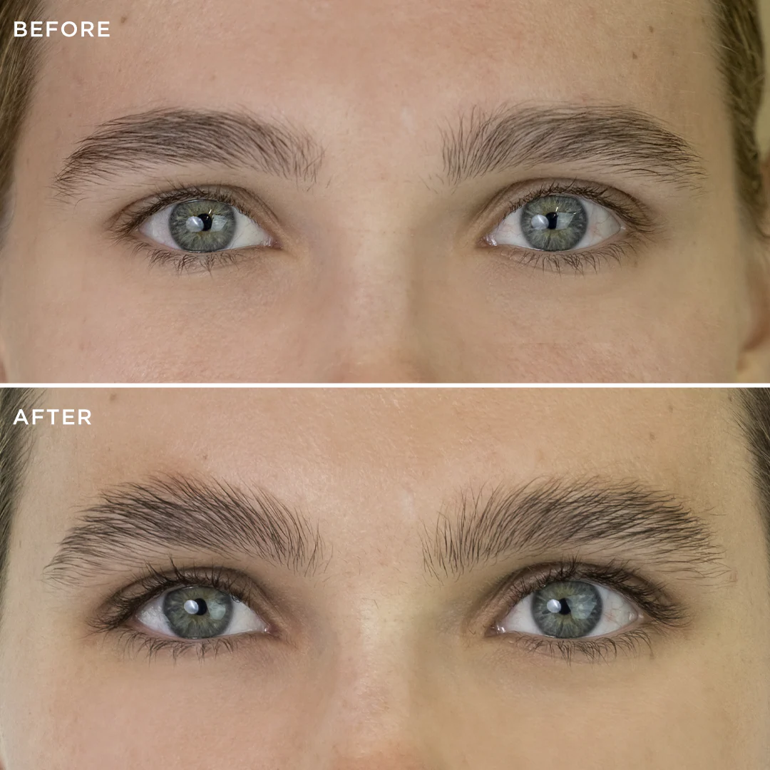 Multi-Peptide Growth Serum - Image 10