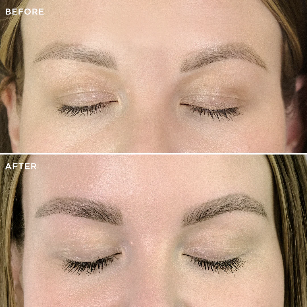 Multi-Peptide Growth Serum - Image 13