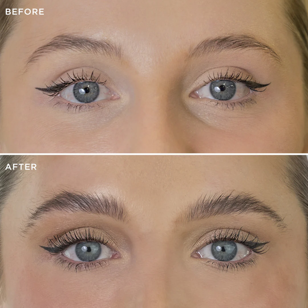 Multi-Peptide Growth Serum - Image 9